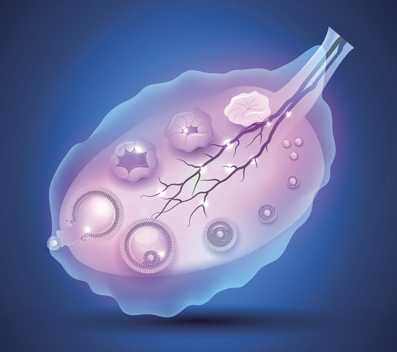 亚美尼亚55岁高龄试管婴儿成功示例